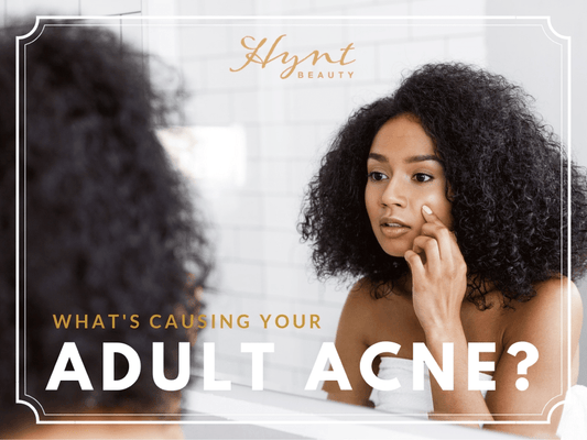 What's Causing Your Adult Acne